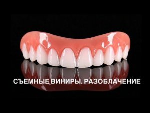 Виниры из КИТАЯ. Купил съемные виниры на Aliexpress