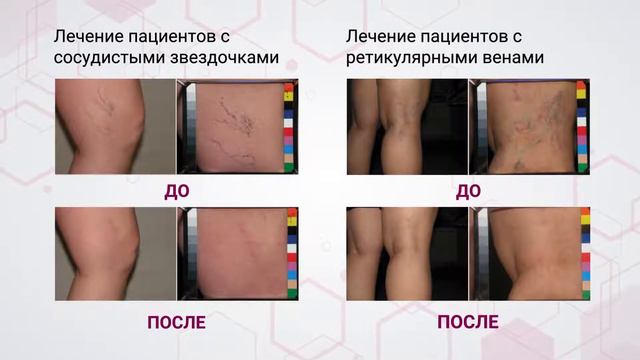 Этоксисклерол смотреть онлайн