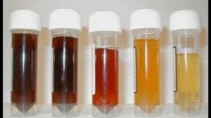 Цвет Мочи Расскажет Всё о Проблемах со Здоровьем