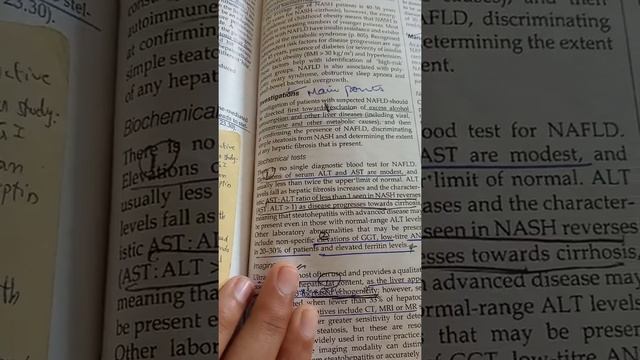 Liver Abcess | Primary Biliary Cirrhosis | Liver and Biliary Tract Disease | Davidson | смотреть онлайн