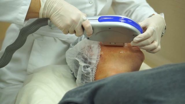 фотомоложение / Фотоомоложение лица смотреть онлайн