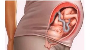 34 НЕДЕЛЯ БЕРЕМЕННОСТИ