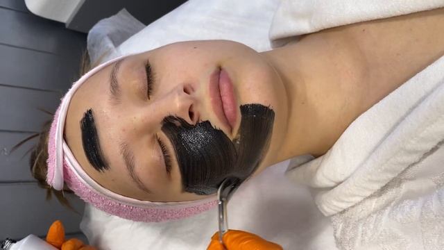 КЛИНИКА LUX | Процедура карбонового пилинга