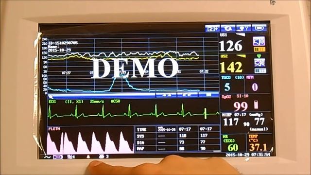 Edan Fetal Monitor Fetal + Maternal Video In Service смотреть онлайн
