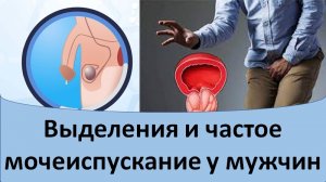 Выделения и частое мочеиспускание у мужчин.