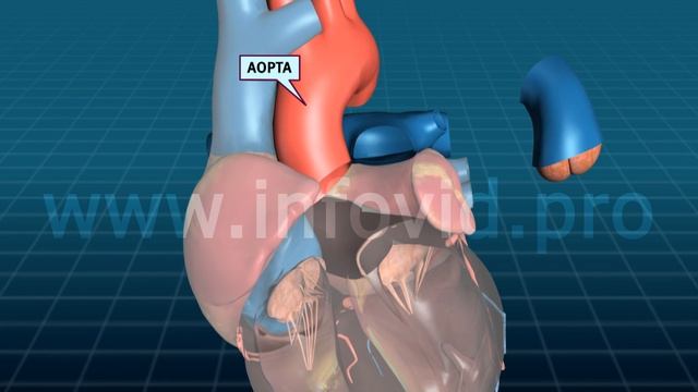 сердце артерия клапан смотреть онлайн