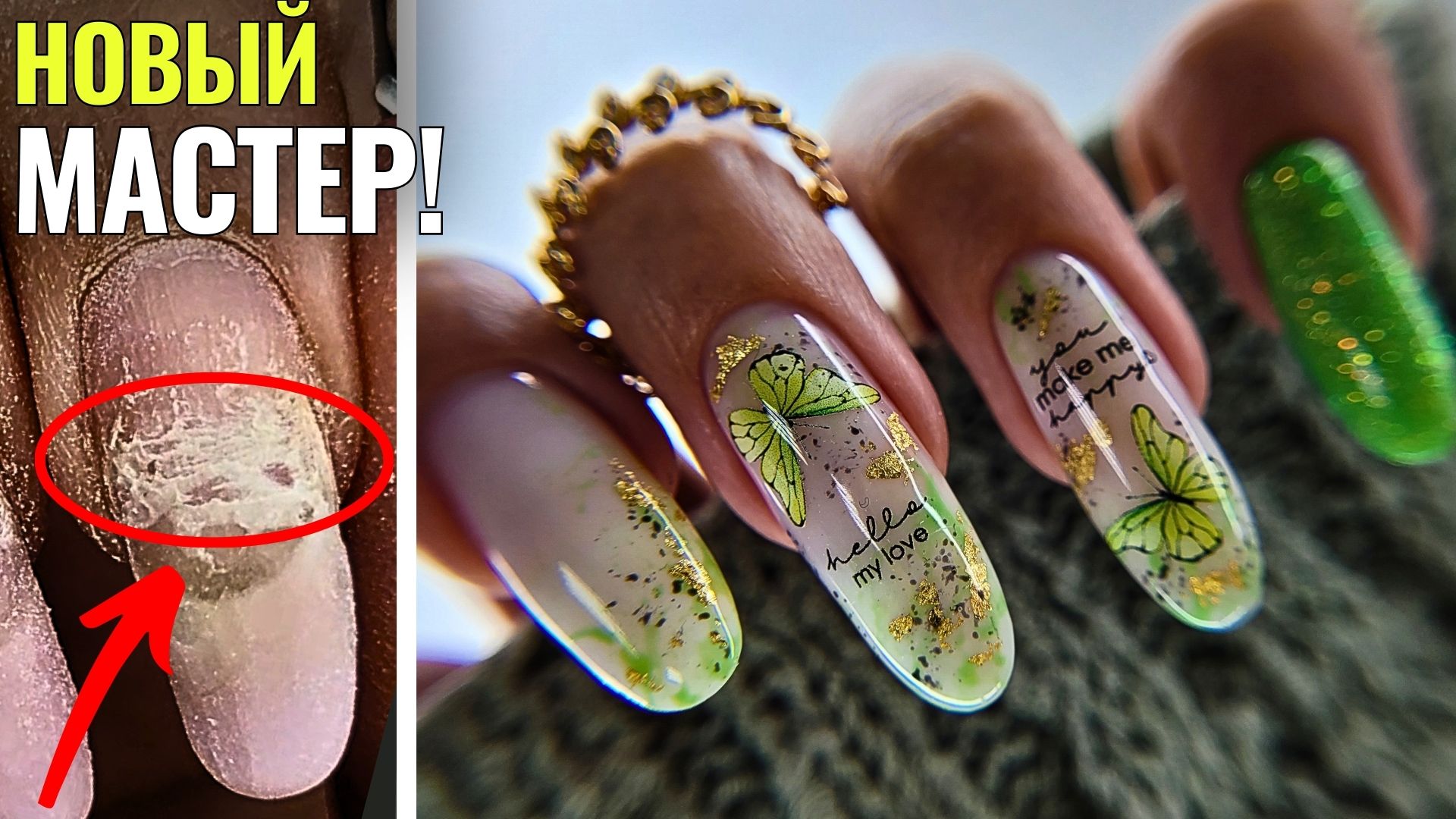 ЧТО С НОГТЯМИ?! ОГРОМНЫЕ ОТСЛОЙКИ и ЖЕСТКИЕ ПОВРЕЖДЕНИЯ! смотреть онлайн