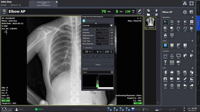 VXvue Quick Guide 03. Post-processing X-ray Images смотреть онлайн