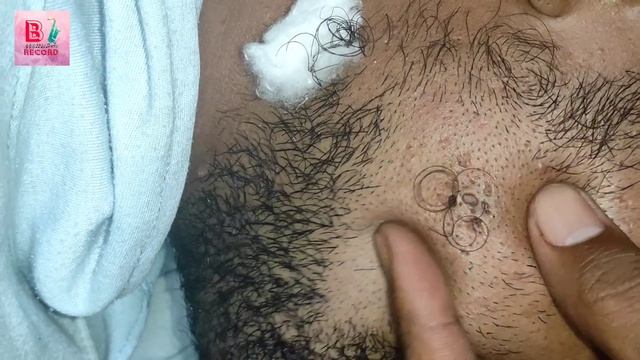 alien blackhead смотреть онлайн