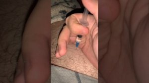 Как сделать укол внутримышечно, если боишься. В первый раз. Как научиться делать укол себе.