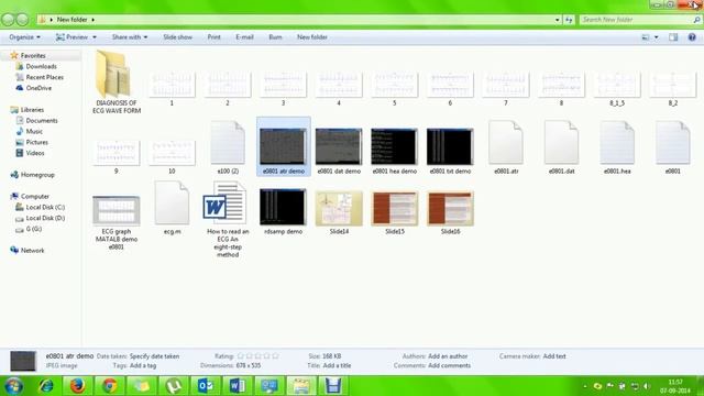 Diagnosis of ECG Waveform By Matlab Without Doctor for rural area смотреть онлайн