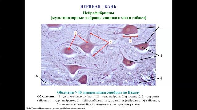 Нервная ткань, описание гистологических препаратов смотреть онлайн