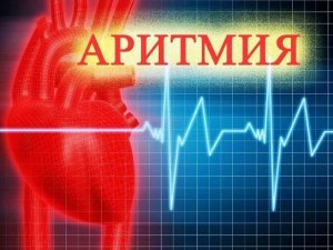 АРИТМИЯ РЕКОМЕНДАЦИИ  НАРОДНЫЕ СРЕДСТВА