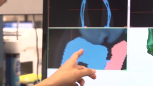 3-D surgery a game changer for veterinary surgery at the University of Florida смотреть онлайн