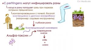 Причина газовой гангрены и пищевых отравлений - Клостридия: патогенез, симптомы, лечение