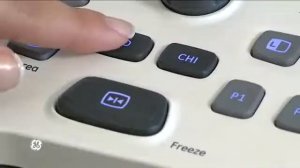 УЗИ-АППАРАТ ЭКСПЕРТНОГО КЛАССА GE LOGIQ F8