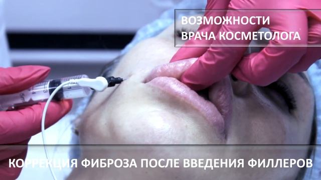 ИННОФИЛЛ ВОЗМОЖНОСТИ смотреть онлайн