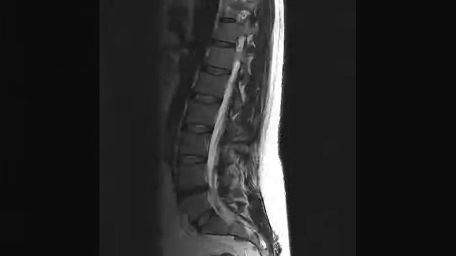 My Spine смотреть онлайн