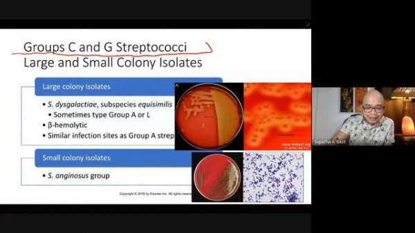 Streptococcus