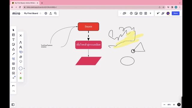ใช้ Miro ทำ Mind map, Flow chart และ Brain storm project | ง่ายจนต้องลืมการทำ Map แบบเดิม смотреть онлайн