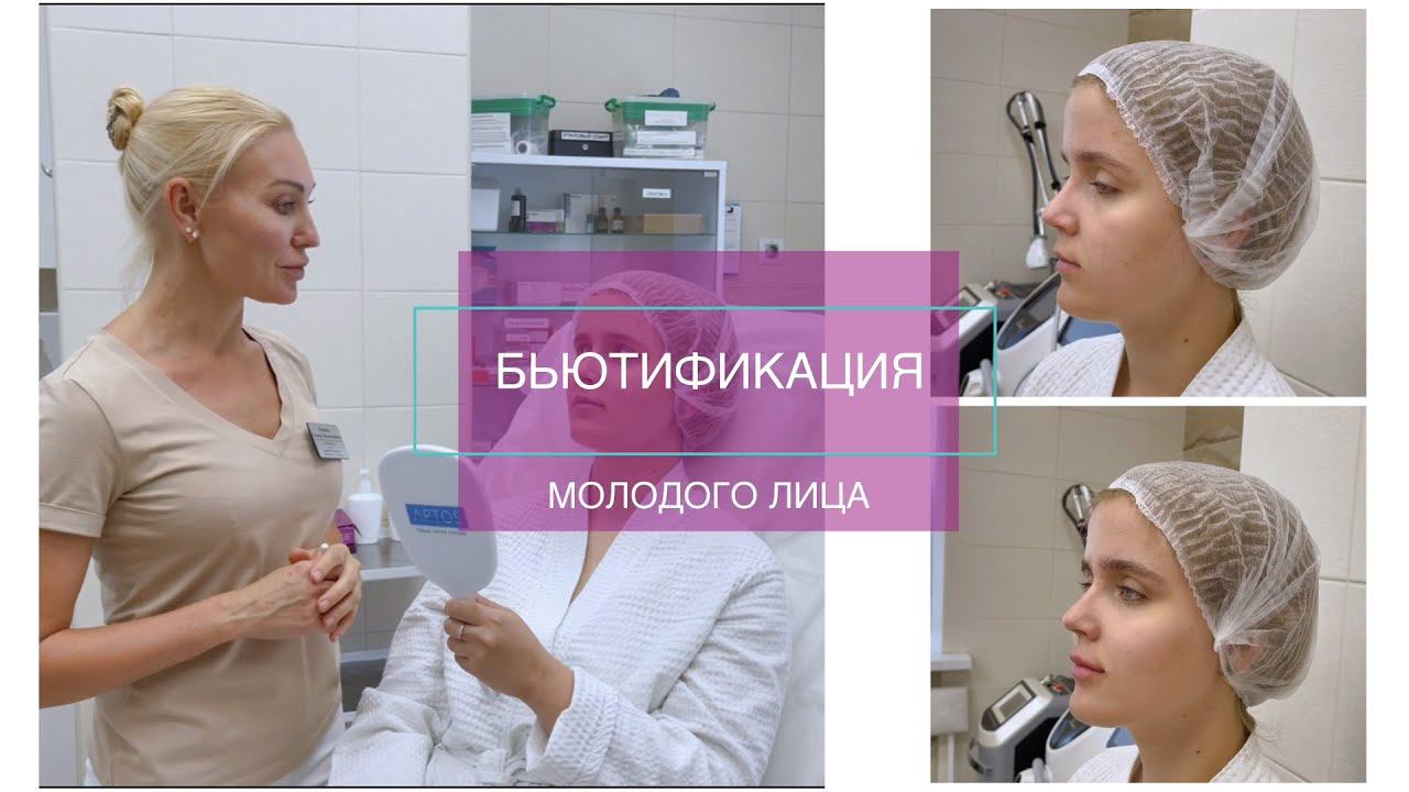 БЬЮТИФИКАЦИЯ молодого лица смотреть онлайн