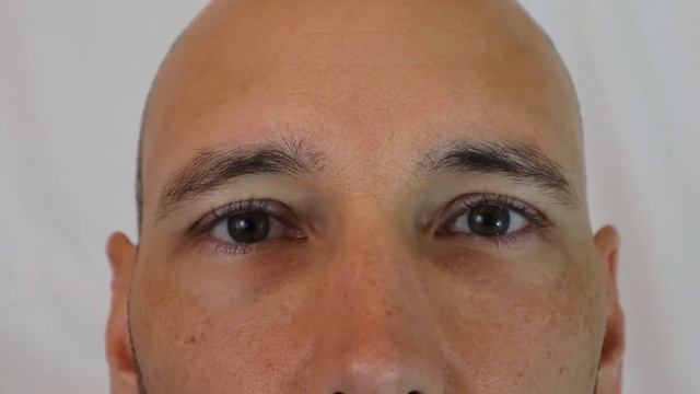 Pupillary Assessment (PERRLA) смотреть онлайн