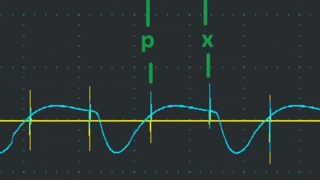 Глохнет при добавлении газа | Часть 2 смотреть онлайн