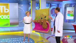 Убрать нельзя оставить: полипы в кишечнике. Жить здорово! Фрагмент выпуска от 03.07.2019