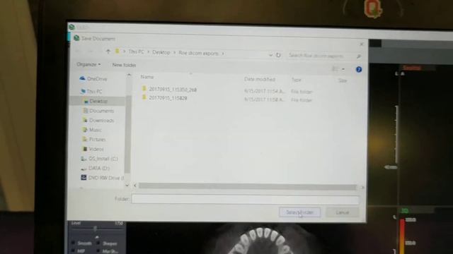 Vatech EZ3dI - How to export DICOM files смотреть онлайн