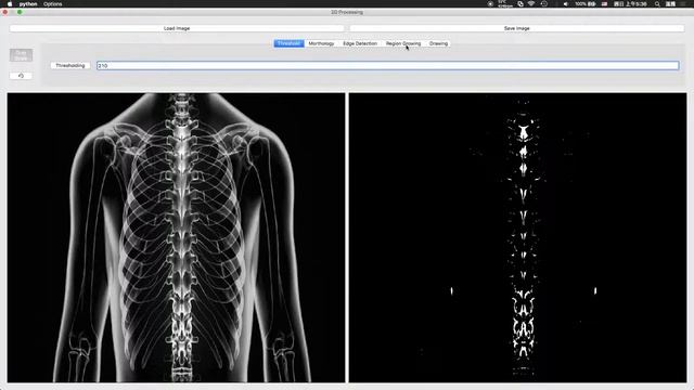 Dicom Viewer Project – 2D Processing Demo смотреть онлайн