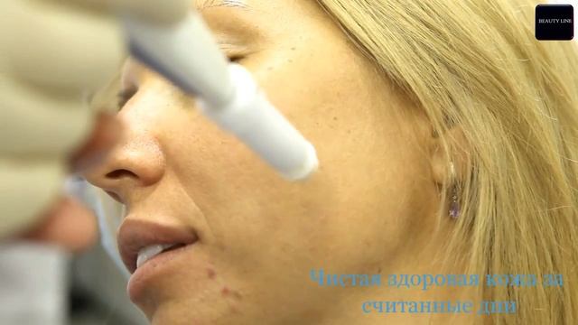 четвёртое состояние вещества и что оно творит в косметологии ! смотреть онлайн