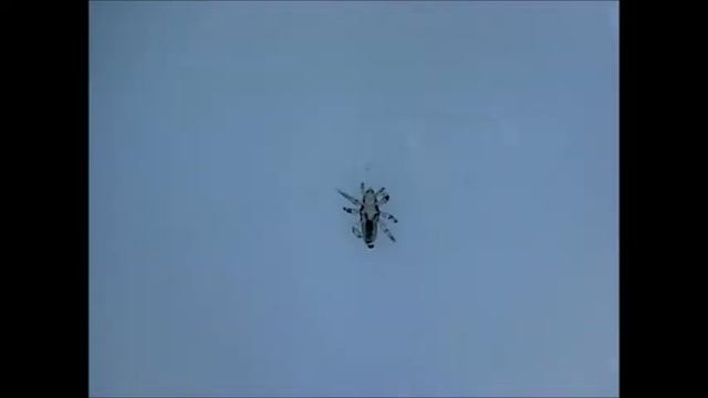 Видео к статье - Педикулез: что делать, если у ребенка вши (1) смотреть онлайн