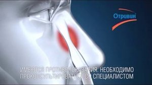 Реклама Отривин: Нос в общежитии