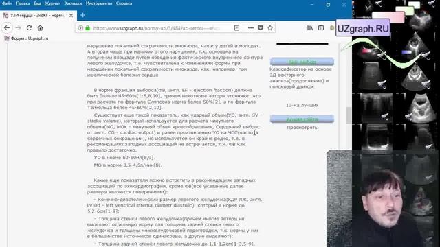 Аудио-статья: Нормы УЗИ - УЗИ сердца / Эхокардиография/ ЭхоКГ - норма смотреть онлайн
