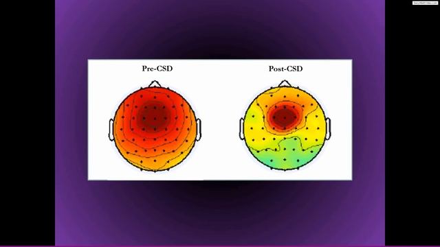 Surface Laplacian for cleaning, topoplogical localization, and connectivity смотреть онлайн