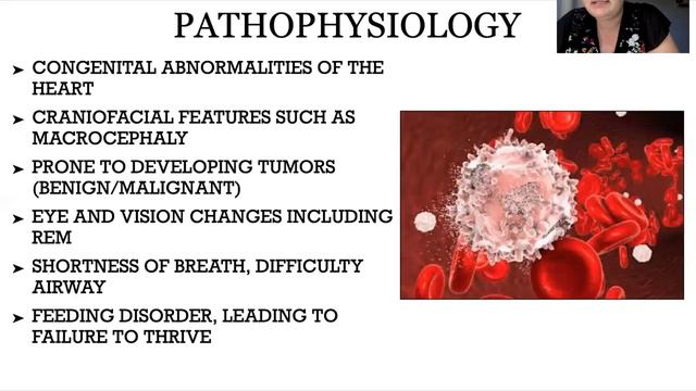 Costello Syndrome Presentation смотреть онлайн