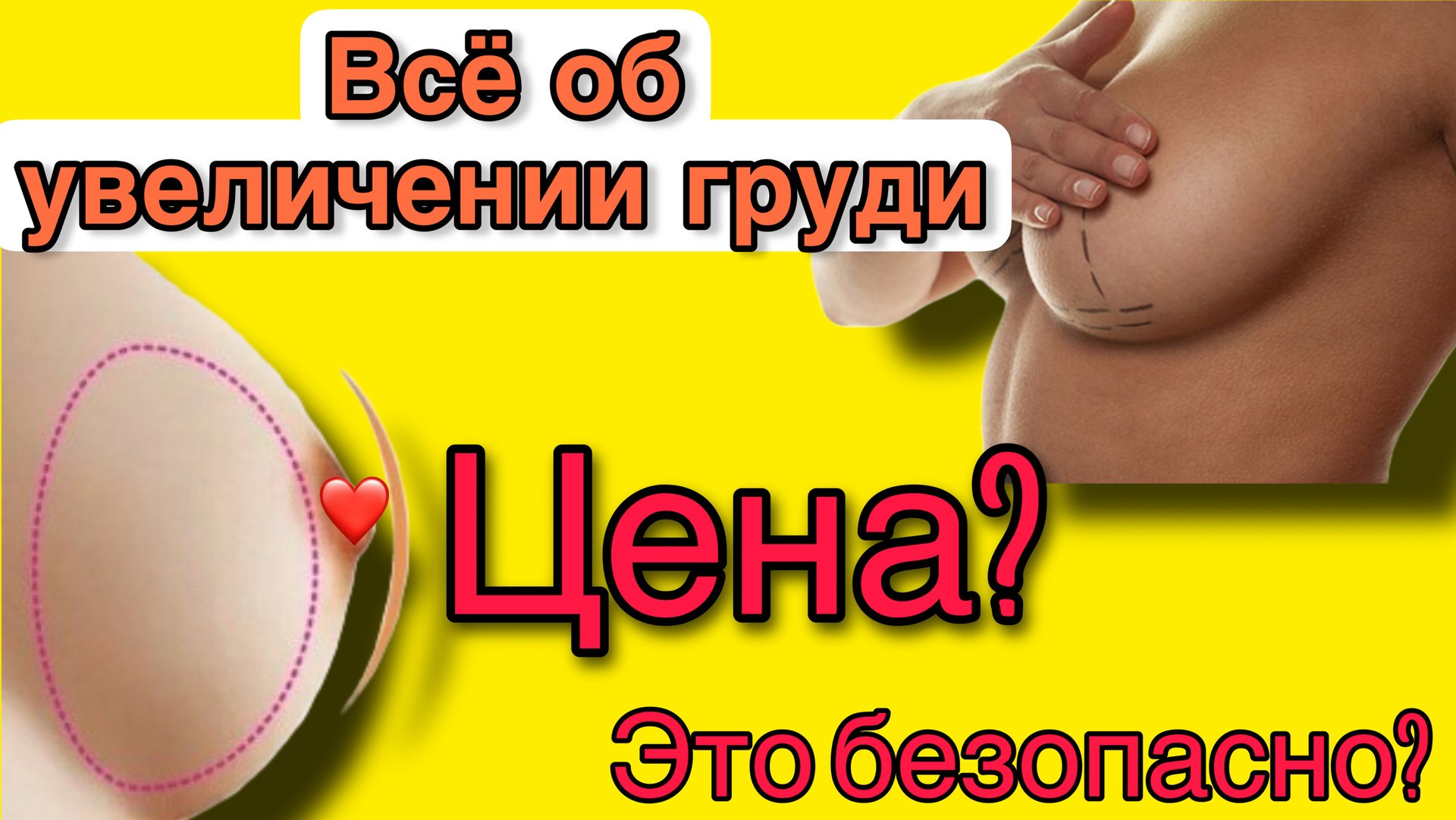 Всё об увеличении и уменьшении груди. Цена операции. Осложнения. Новинки в пластической хирургии. смотреть онлайн