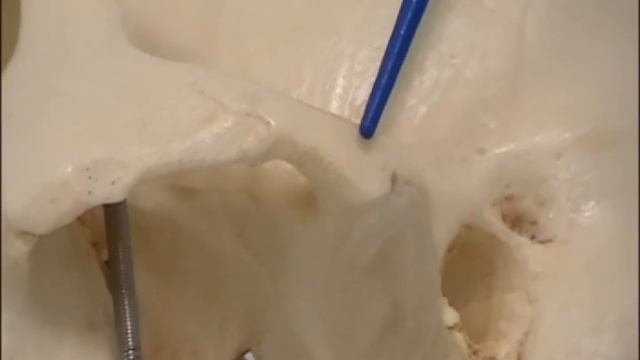Osteology of the skull: 4 Lateral View смотреть онлайн