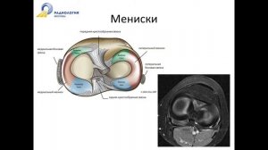 Базовый курс по МРТ  «МР анатомия коленного сустава и методика сбора данных»  Лектор Катков А М