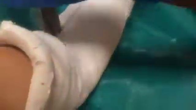 Снимают гипс смотреть онлайн