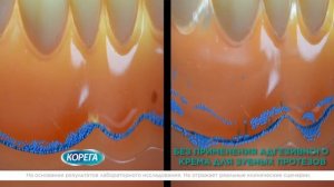 Корега – Прилегание зубного протеза
