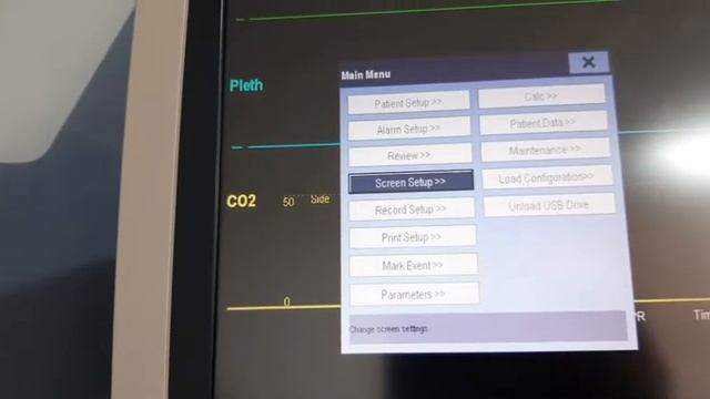 Demonstration of cardiac monitor Mindray ImEc 15 by Nadia Jadoon and ICU team смотреть онлайн