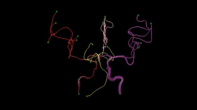 Automated workflow for brain vessel analysis смотреть онлайн