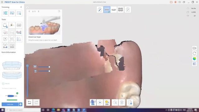 Scanning a Replica Denture with Medit Scanner i600 смотреть онлайн