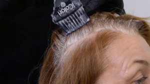 Предпигментация седины