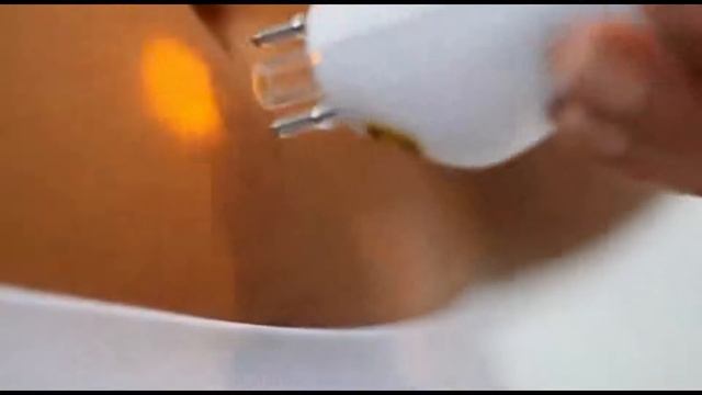 Лазерный эпилятор RIO Salon Laser Tweezer
