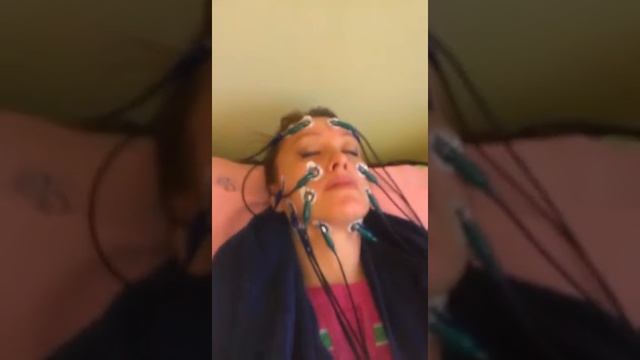 Электромиостимуляция лица. смотреть онлайн