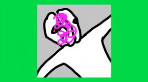 Человек-Ракушка,кто такой,и история травмы#Человек-ракушка