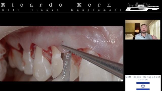 Профессор Доктор Рикардо Керн - Пластика Мягких Тканей (специальный вебинар) смотреть онлайн