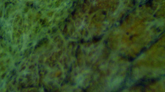 Клещ грушевый галловый смотреть онлайн